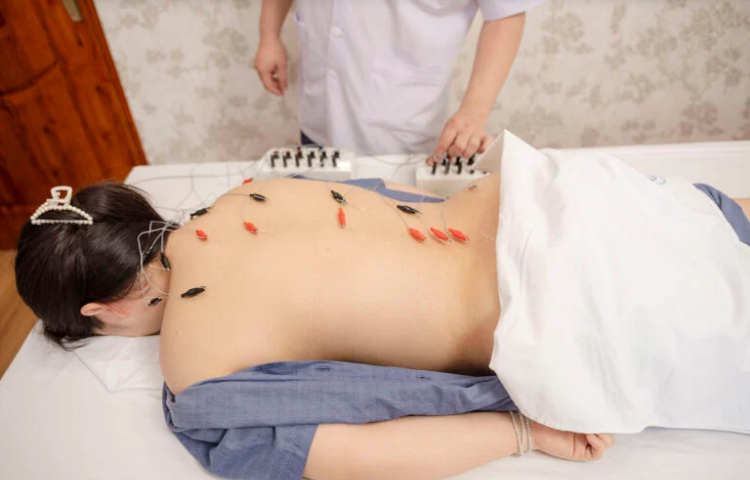 Điện châm điều trị Stress (Căng thẳng, Chứng uất)